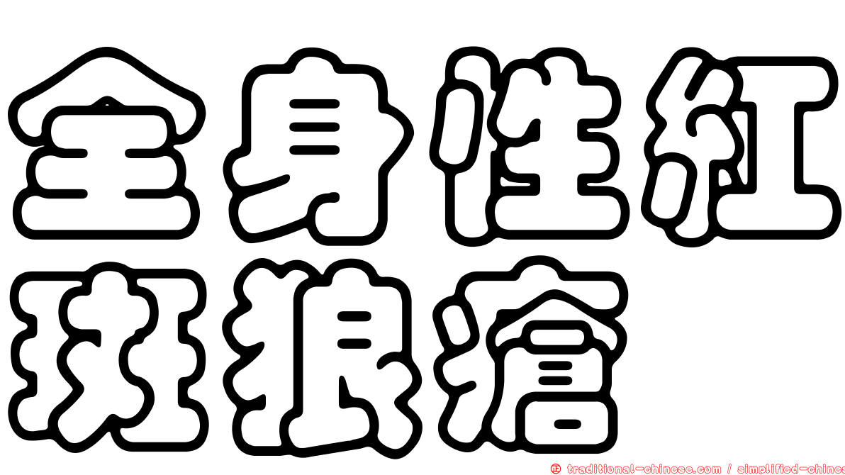 全身性紅斑狼瘡