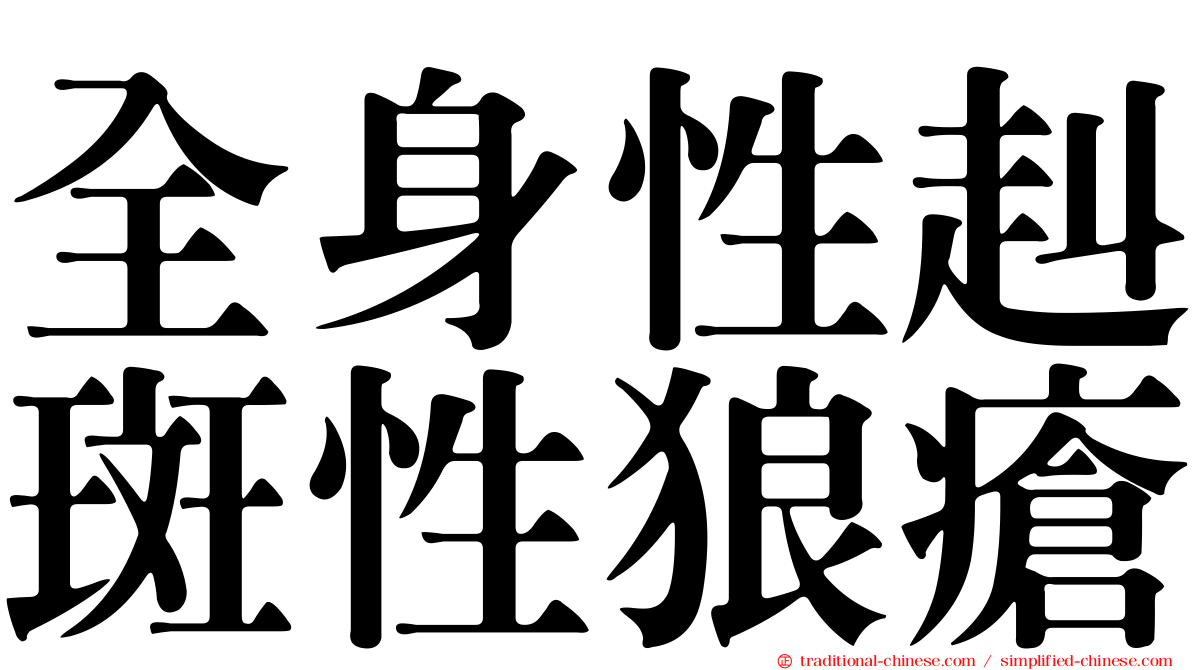 全身性赳斑性狼瘡