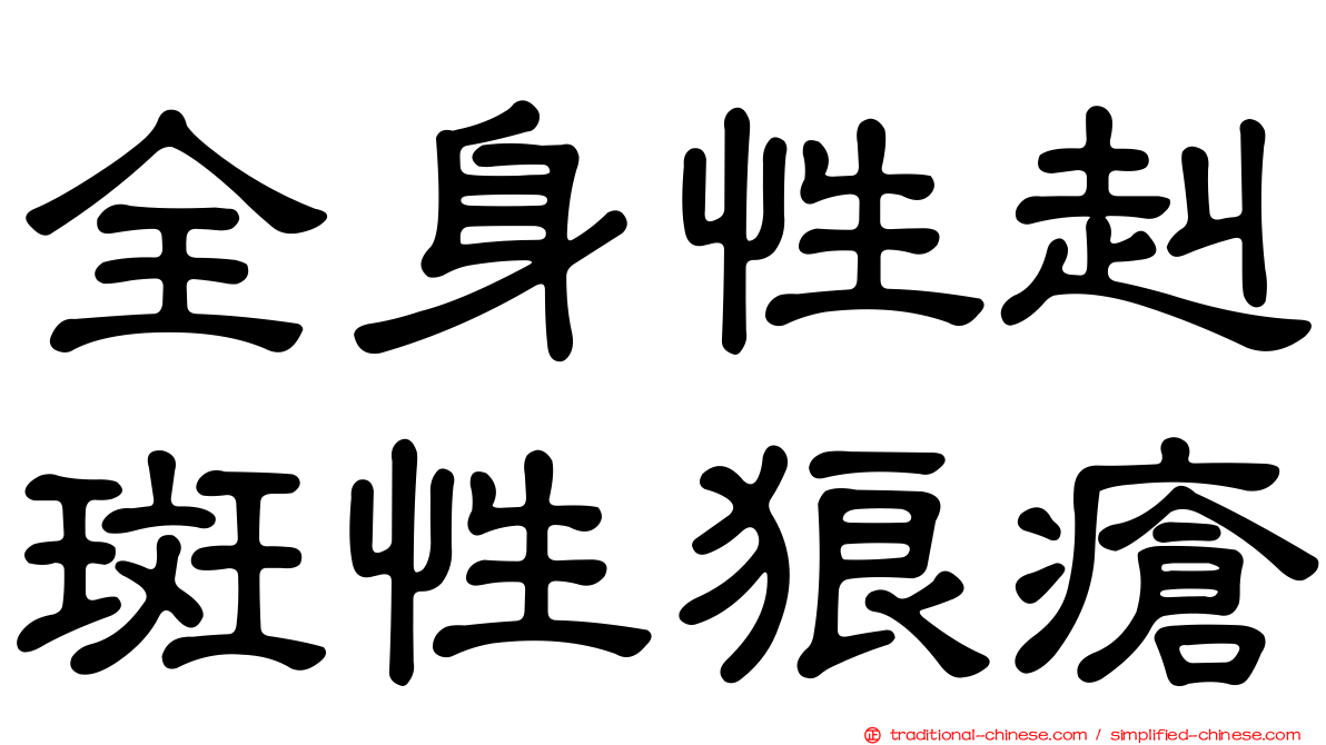 全身性赳斑性狼瘡