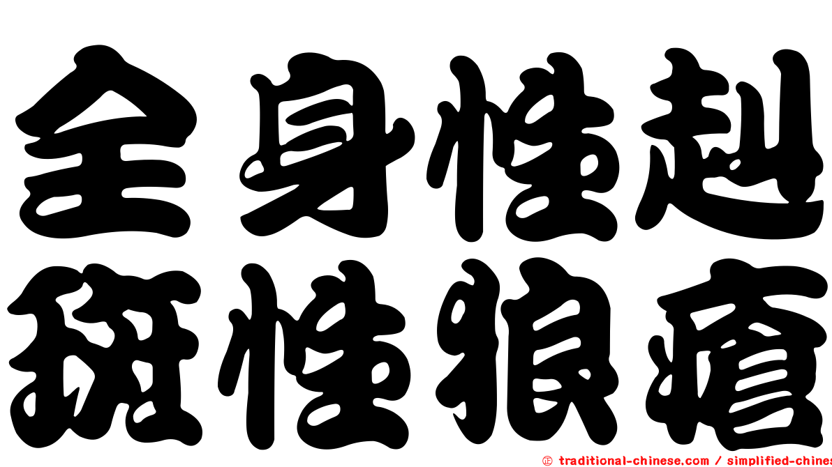 全身性赳斑性狼瘡