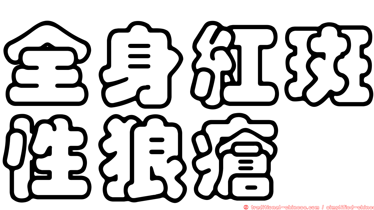 全身紅斑性狼瘡