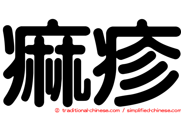 痲疹
