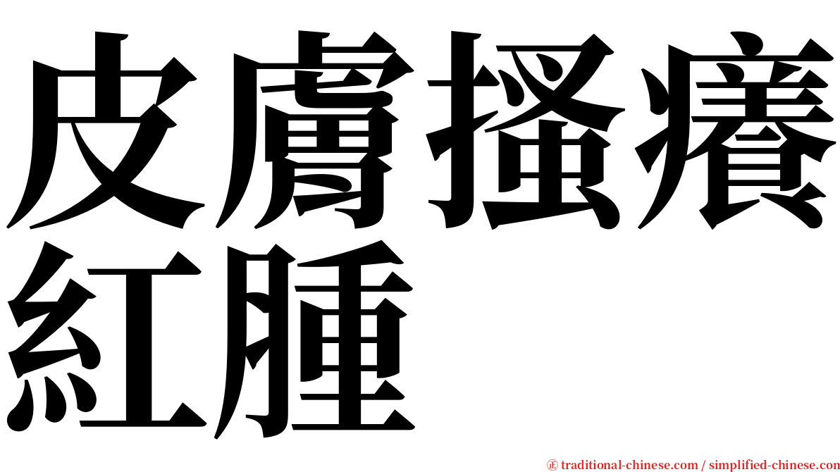 皮膚搔癢紅腫 serif font