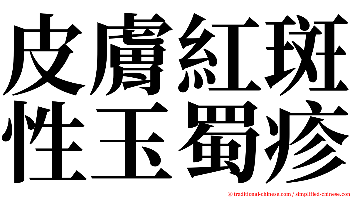 皮膚紅斑性玉蜀疹 serif font